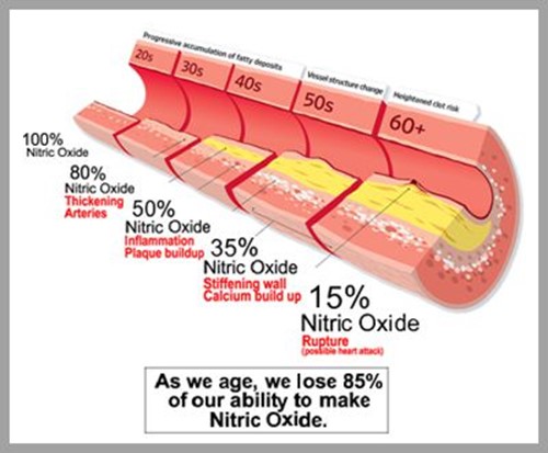 artery blockage build up by age range showing the decrease in nitric oxide in the vessels